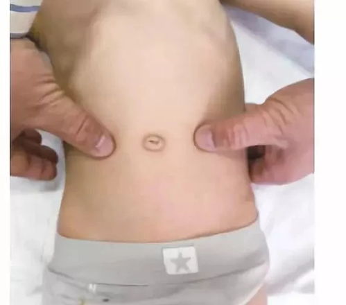 小儿推拿宝典 小儿保健四穴，按摩保健的妙法